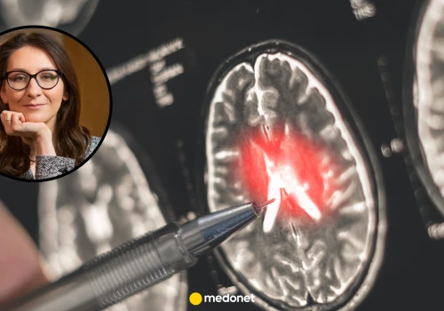 Błędne diagnozy stwardnienia rozsianego. Neurolog potwierdza: to się zdarza