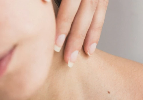 Niszczysz naturalną ochronę swojej skóry? Zobacz, jak probiotyki potrafią odmienić pielęgnację!