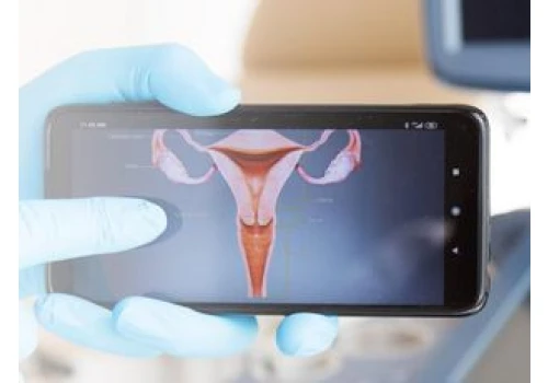 Bezpłatne badania w kierunku HPV na NFZ. Mogą skorzystać mieszkanki Torunia