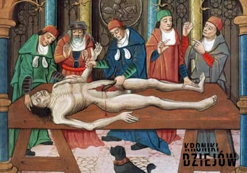 Płacili za bilety, żeby oglądać rozcinanie zwłok. Tak wyglądały dawne widowiska
