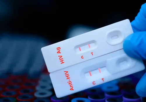 Rekordowa ilość zakażeń wirusem HIV w Polsce. Posłowie pytają o leczenie
