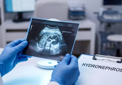 Wodonercze – objawy, diagnostyka, leczenie, rokowania
