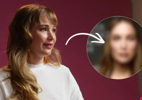 Jennifer Lawrence to już inna osoba. Ostrzykiwanie twarzy poszło za daleko