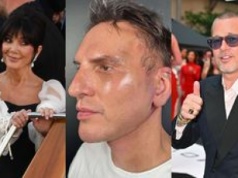 TYLKO NA PUDELKU: Krzysztof Gojdź pokazał się przed i po liftingu za 150 tys zł. 