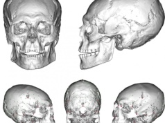 W Europie już 12 000 lat temu celowo modyfikowano kształt czaszki