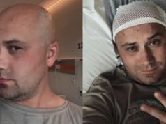 Adrian ze "Ślubu od pierwszego wejrzenia" przeszedł KOLEJNY ZABIEG. "Po usunięciu guza mózgu powstał krwiak"