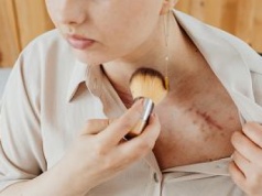 Onkokosmetologia. Chore chcą normalnie pracować, wychodzić do ludzi, funkcjonować na tyle, na, ile im starcza sił