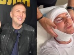 Krzysztof Gojdź prezentuje wygładzone lico MIESIĄC PO LIFTINGU. Nie kryje zachwytu: 