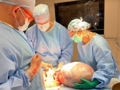 Gigantyczny guz jajnika usunęli mieszkance regionu onkolodzy z Bydgoszczy [zdjęcia]