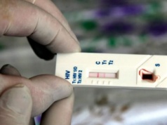 W rosyjskiej armii pojawią się oddziały żołnierzy z HIV i wirusowym zapaleniem wątroby — będą nosić specjalne opaski