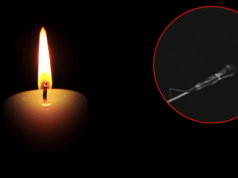 Była 11:00, gdy podano tragiczne wieści. Okrutna choroba zabiła legendę rocka