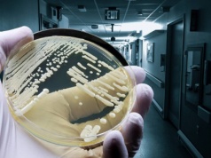 Groźny grzyb szpitalny rozprzestrzenia się w Europie. 120 przypadków w Niemczech – Polska w strefie ryzyka