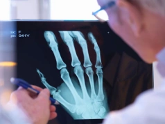 Wymyślono nowy klej do kości. To przyśpieszy gojenie złamań