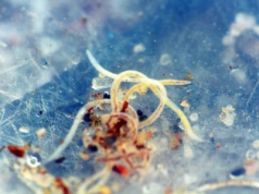 Jak wygląda owsik? Najwięcej pasożytów wychodzi w nocy