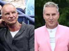 Sting majstrował przy twarzy? Krzysztof Gojdź nie ma wątpliwości. Cała lista