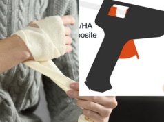 Drukarka do kości drukuje implanty dokładnie tam, gdzie są potrzebne