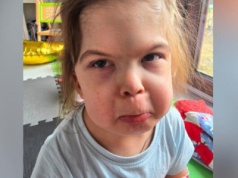 Nie do wiary! Ponad milion złotych od firmy Roberta Lewandowskiego. 7-letnia Amelka z Wójtowa przejdzie operację w Bostonie