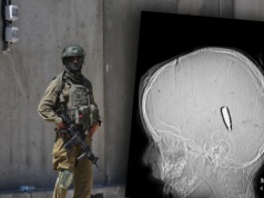 Ponad setka palestyńskich dzieci postrzelonych w głowę i tors. Eksperci: To pokazuje celowe działanie