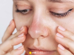 To serum wyeliminuje zaskórniki jak laser. "Moja skóra nigdy nie była tak czysta"