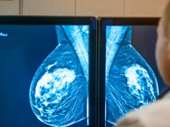 Przełom w terapii raka piersi. Skuteczny sposób na eliminację nawrotów