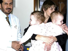 Bliźniaczki syjamskie z Janikowa po 20 latach od rozdzielenia