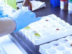 Akredytacje zakładów patomorfologii zostaną przedłużone? "Jest taka opcja"