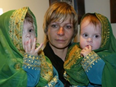 Polska pamięta ich historię. Tak dziś wyglądają bliźniaczki syjamskie z Janikowa 20 lat po operacji