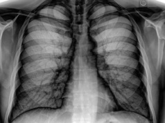 Perowskitowa kamera pozwala zajrzeć do ludzkiego wnętrza. Technologia przyszłości już działa