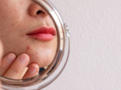 Obsesja na punkcie skóry. "Brałam na imprezy żel do mycia twarzy"