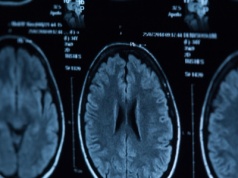 Jak fale mózgowe podczas snu pomagają usuwać toksyny z naszego mózgu