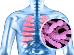 Eksperci: Szczepionki na pneumokoki nie są dostosowane do realnych zagrożeń