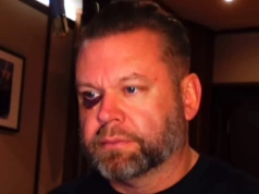 Znany muzyk poważnie ranny. Działał w słusznej sprawie