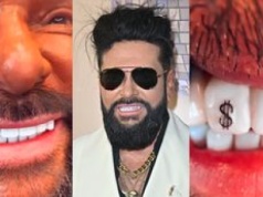 UWAGA, WAŻNE: Krzysztof Rutkowski sprawił sobie nową ozdobę. Teraz ma na zębie... DOLARA. Uśmiech "na bogato"?