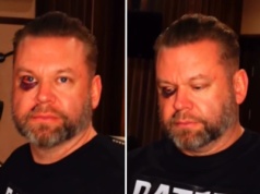Znany producent muzyczny pobity w barze! Pokazał obrażenia. "Sześć szwów, trzy złamane zęby"