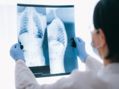 Przełom w gastroenterologii – kapsułka FIREFLI do połykania diagnozuje zaburzenia jelitowe