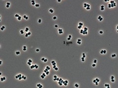 Ta bakteria "udaje martwą". NASA przypadkiem wysłała ją na Marsa