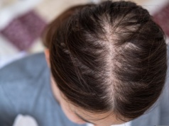 Twoje włosy są rzadkie i oklapnięte? Ten domowy sposób działa lepiej niż maski za 100 zł