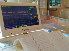 Rewolucja w szpitalach. Pacjenci zyskają łatwiejszy dostęp do terapii ratujących życie