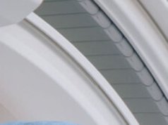 Coraz więcej młodych osób po udarze. Lublin znów w czołówce leczenia