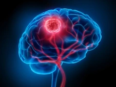 Ekspertka: 5 objawów guza mózgu, które trzeba umieć rozpoznać