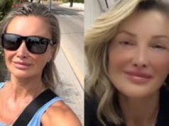 Zafundowała sobie nową twarz w tureckiej klinice. Trudno uwierzyć, ILE MA LAT. Zgadniecie?