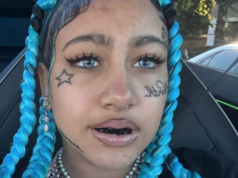 Groźny trend wśród nastolatków. "To szkody, które zostaną z nimi na całe życie" – alarmuje dentysta