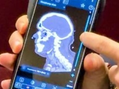 Rusza Dolnośląska Sieć Udarowa. To pionierski projekt 12 dolnośląskich szpitali