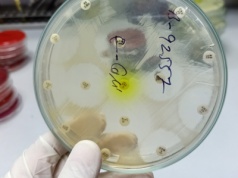 "Wyprzedza postępy medycyny". Zagrożenie rośnie, nowy alarm ogłoszony