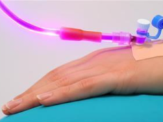 Jak wprowadzenie promieniowania UV do krwi leczy wszystko, od infekcji po choroby serca