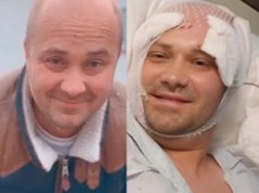 Adrian Szymaniak ze "ŚOPW" przekazał nowe wieści w sprawie leczenia. Wyniki BADAŃ dobrze rokują