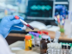 Diagnostyka zwiększyła przychody i zyski. Spółka szuka okazji do kolejnych akwizycji