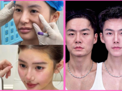 Trójkątna twarz i oczy jak z kreskówki. Młodzi Azjaci operują się na potęgę