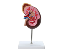 Hiperaldosteronizm – przyczyny, objawy i leczenie