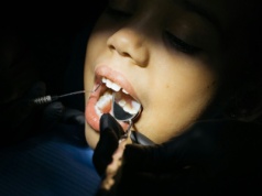 Pogotowie stomatologiczne to zdzierstwo. Ten dentysta ma inny pomysł na leczenie nagłego bólu zęba